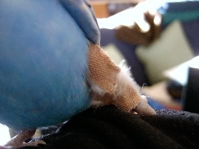 Bobbysbrokenleg016.jpg