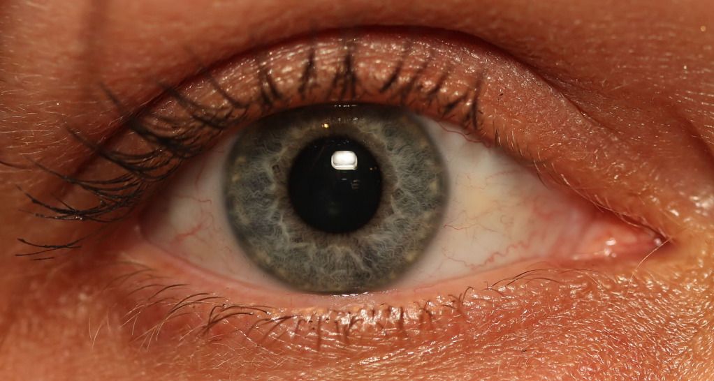 IMAGE: http://i36.photobucket.com/albums/e28/dhayling/DFH_eye.jpg