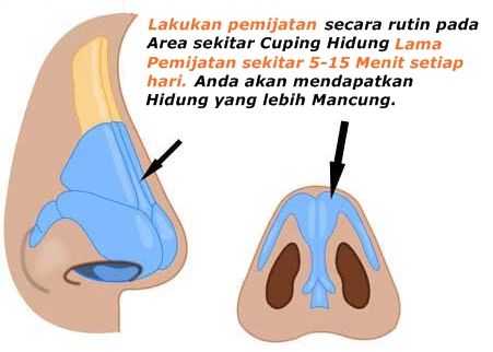 Cara Memancungkan Hidung Pesek Secara Alami Dengan Dicubit