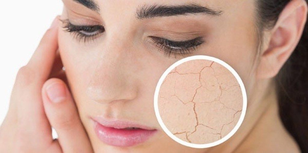 Cara Mengatasi Kulit Kering Karena AC Dengan Cepat